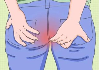 【宜昌肛泰医院怎么样】肛裂在什么情况下需要做手术？